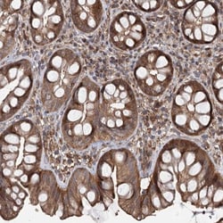 RNF111 Antibody, Novus Biologicals:Antibodies:Primary Antibodies